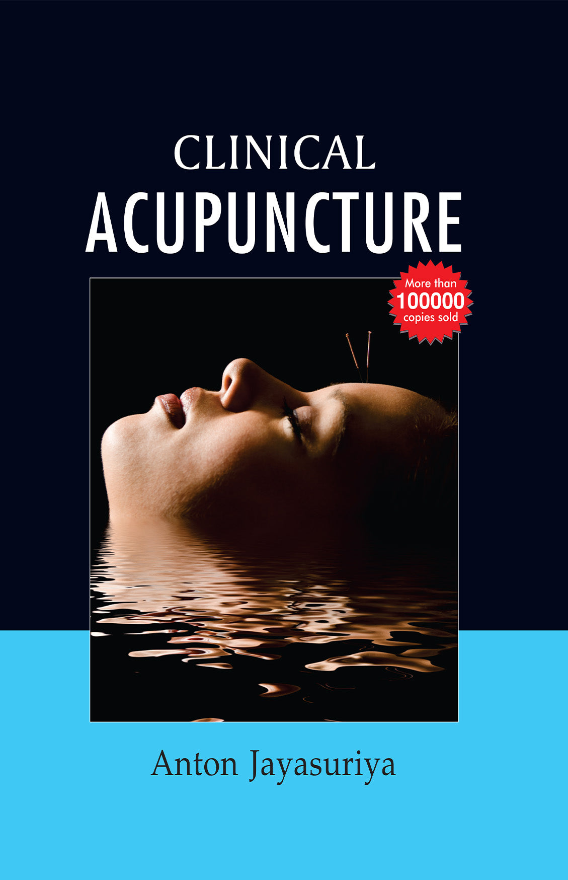 Clinical Acupuncture With Chart