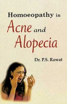 Homoeopathy In Acne And Alopecia