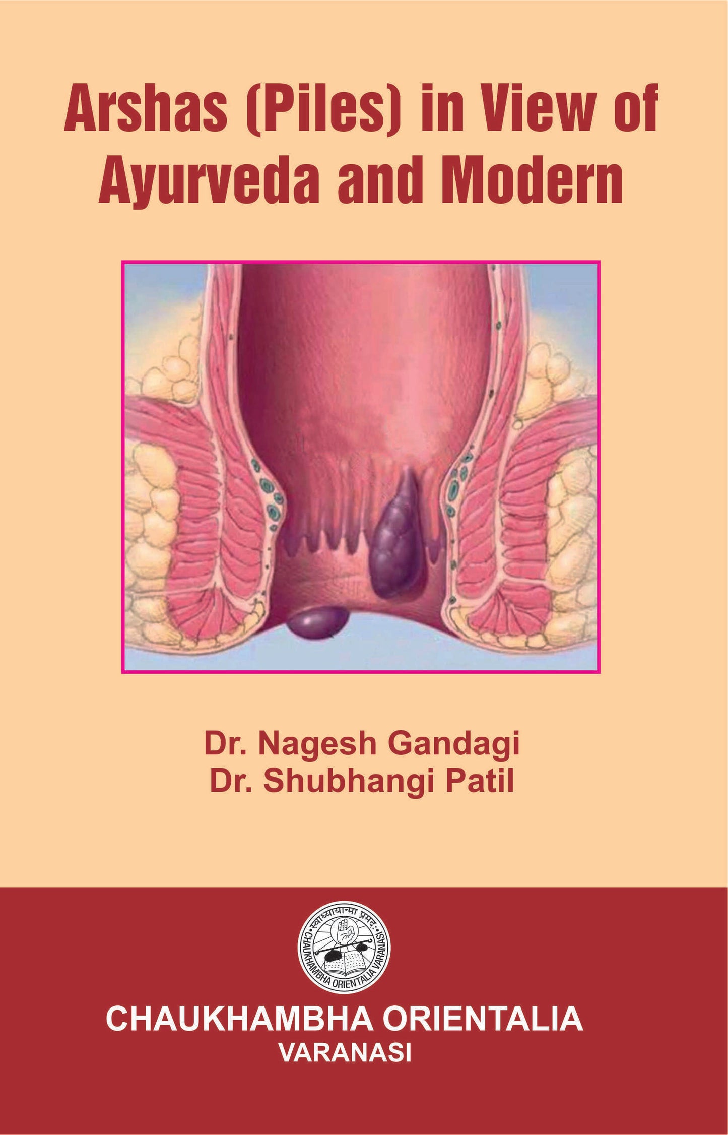 Chaukhambha Orientalia Arshas (Piles) in view of Ayurveda and Modern Medicine